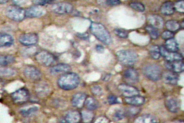 SRC Antibody (Thr523)