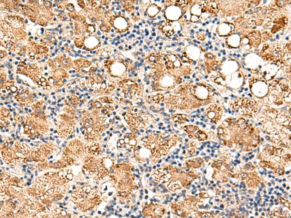 NEGR1 / Neurotractin Antibody