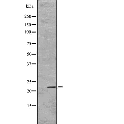 Polyclonal Rabbit anti-Human ID / ID1 Antibody (IHC, IF, WB)