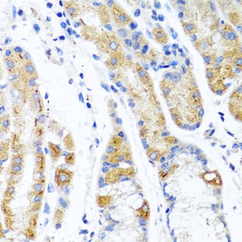 CST1 / Cystatin SN Antibody