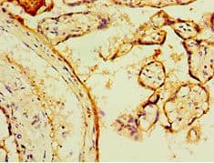 TGM2 / Transglutaminase 2 Antibody (aa438-687)
