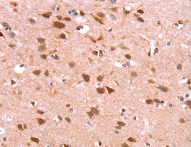 Polyclonal Rabbit anti-Human GH / Growth Hormone Antibody (IHC, WB)