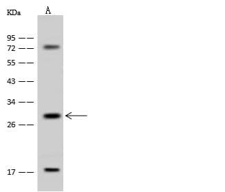 ICMT / PPMT Antibody