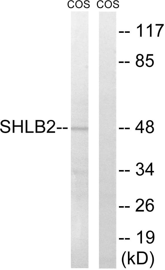 SH3GLB2 / Endophilin-B2 Antibody (aa131-180)