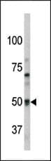 PAEL Receptor / GPR37 Antibody (aa97-126)