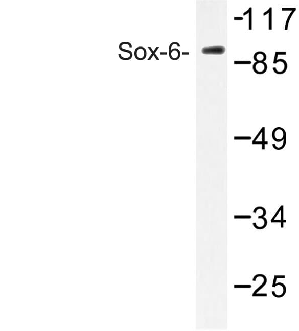 SOX6 Antibody (Asp23)