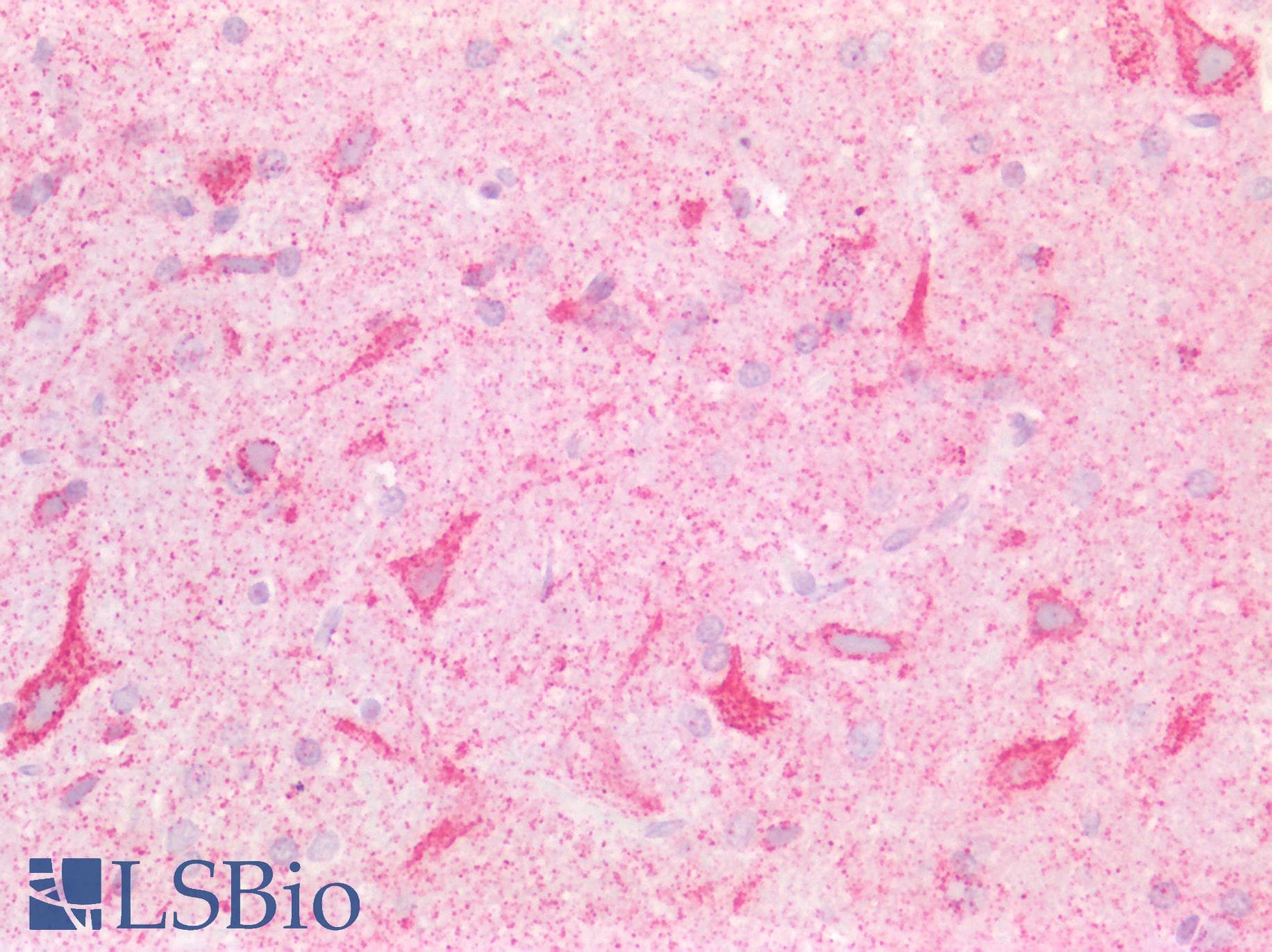 IHC-plus™ CD95 / FAS Antibody (N-Terminus)