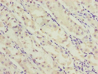 Polyclonal Rabbit anti-Human SLC52A2 / GPR172A / PAR1 Antibody