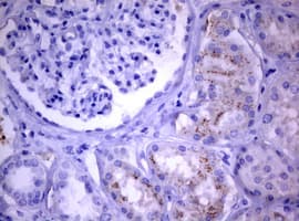 PIK3C2A Antibody (aa230-560, clone OTI3H2)