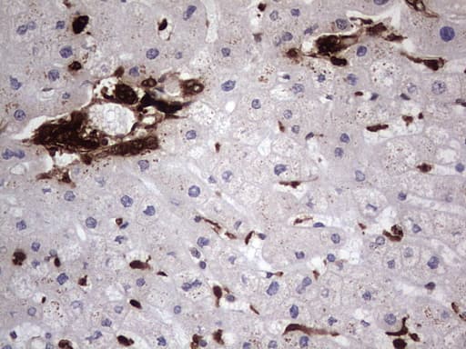LGALS3 / Galectin 3 Antibody (clone OTI6E1)