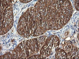 DNM1L / DRP1 Antibody (clone OTI4B5)