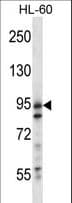 USP20 / VDU2 Antibody (aa310-339)