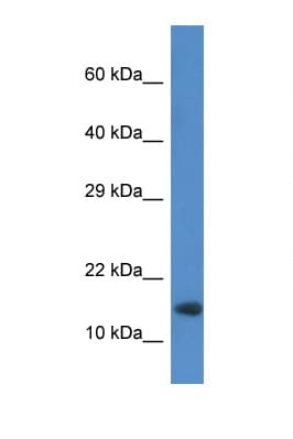 Polyclonal Rabbit anti-Mouse RNF122 Antibody (aa52-101, WB)