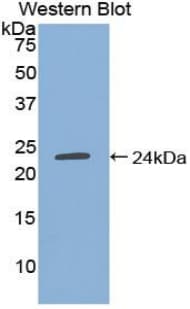 TIMP4 Antibody (aa32-224, Biotin)