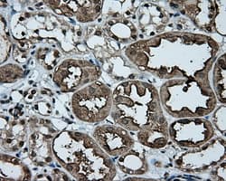 Monoclonal Mouse anti-Human TLDC1 / KIAA1609 Antibody (clone OTI5D9, IHC, IF, WB)