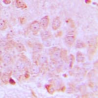 SLC25A21 / ODC1 Antibody (Internal)