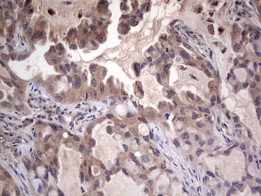 Monoclonal Mouse anti-Human LGALS3 / Galectin 3 Antibody (clone OTI15E4, Carrier-free, IHC, WB)
