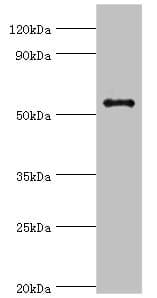 GPS1 / CSN1 Antibody (aa222-491)
