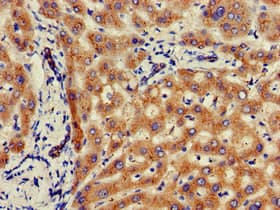 GLB1 / Beta-Galactosidase Antibody