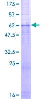 Human GRPR Protein (Recombinant GST)