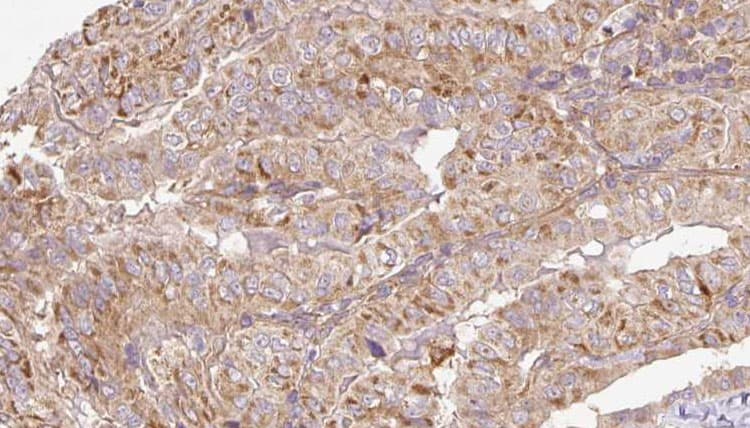 RAB14 Antibody