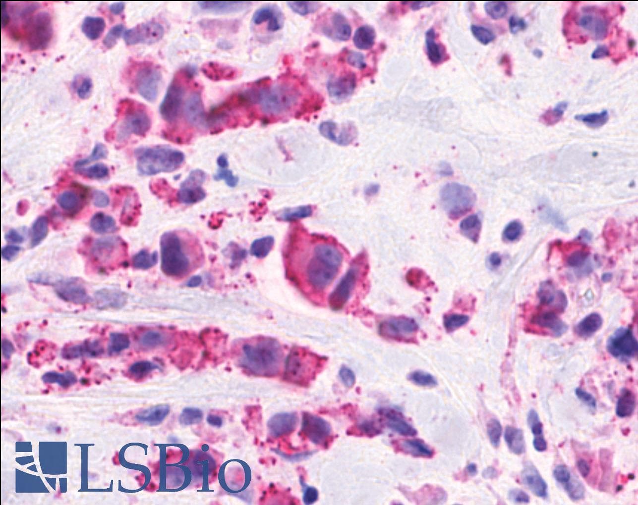 PathPlus™ CELSR2 Antibody (N-Terminus)