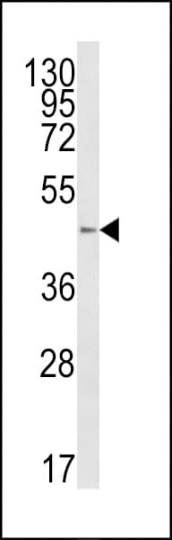 Polyclonal Rabbit anti-Human B4GALT1 Antibody (aa329-358, WB)