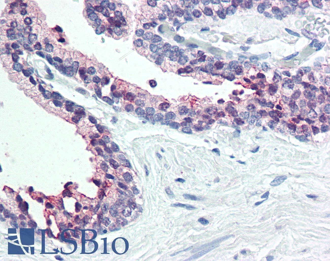 IHC-plus™ STEAP2 Antibody (C-Terminus)