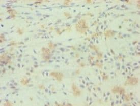 RORC / ROR Gamma Antibody (aa1-518)