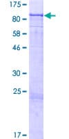Human Complement C2 Protein (Recombinant GST)