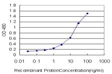 Monoclonal Mouse anti-Human PDGFRA / PDGFR Alpha Antibody (clone 2D2-1A11, WB)
