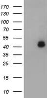 LHX1 Antibody (clone OTI2G3)