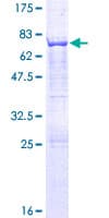 Human AP3M1 Protein (Recombinant GST)