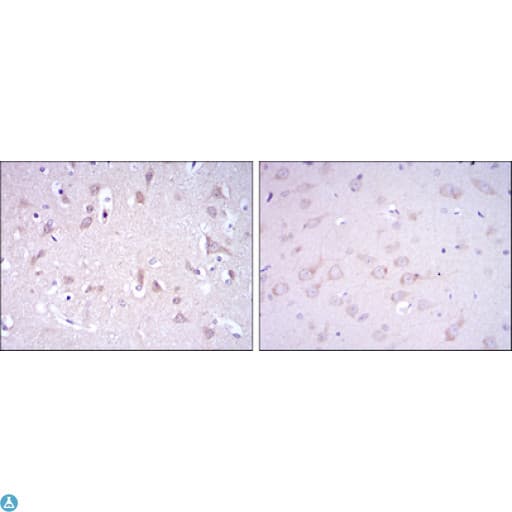 GRIA3 / GLUR3 Antibody
