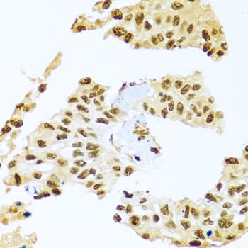 Polyclonal Rabbit anti-Human SMEK1 Antibody (IHC, WB)