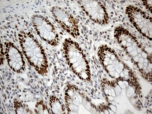 Monoclonal Mouse anti-Human RB1 / Retinoblastoma / RB Antibody (clone OTI11C10, aa309-590, IHC, WB)