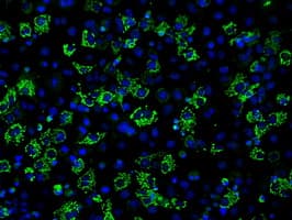 ACO2 / Aconitase 2 Antibody (clone OTI3G8)