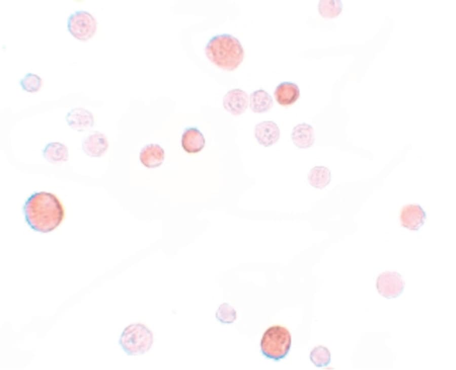 IHC-plus™ PLAC1 Antibody