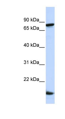 ZNF281 / Zfp281 Antibody (C-Terminus)