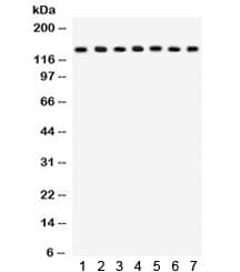 DLG1 / SAP97 Antibody