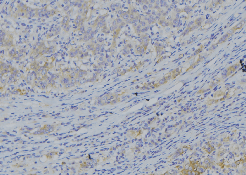 NDUFA10 Antibody