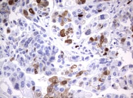 Monoclonal Mouse anti-Human TS / Thymidylate Synthase Antibody (clone OTI1D6, IHC, WB)
