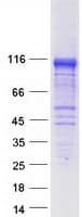 Human MACS / RIN2 Protein (Recombinant Myc-DDK (Flag))