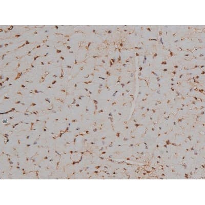 MAPT / Tau Antibody (phospho-Thr231)
