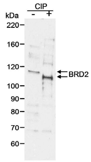 Polyclonal Goat anti-Human BRD2 / RING3 Antibody (WB)