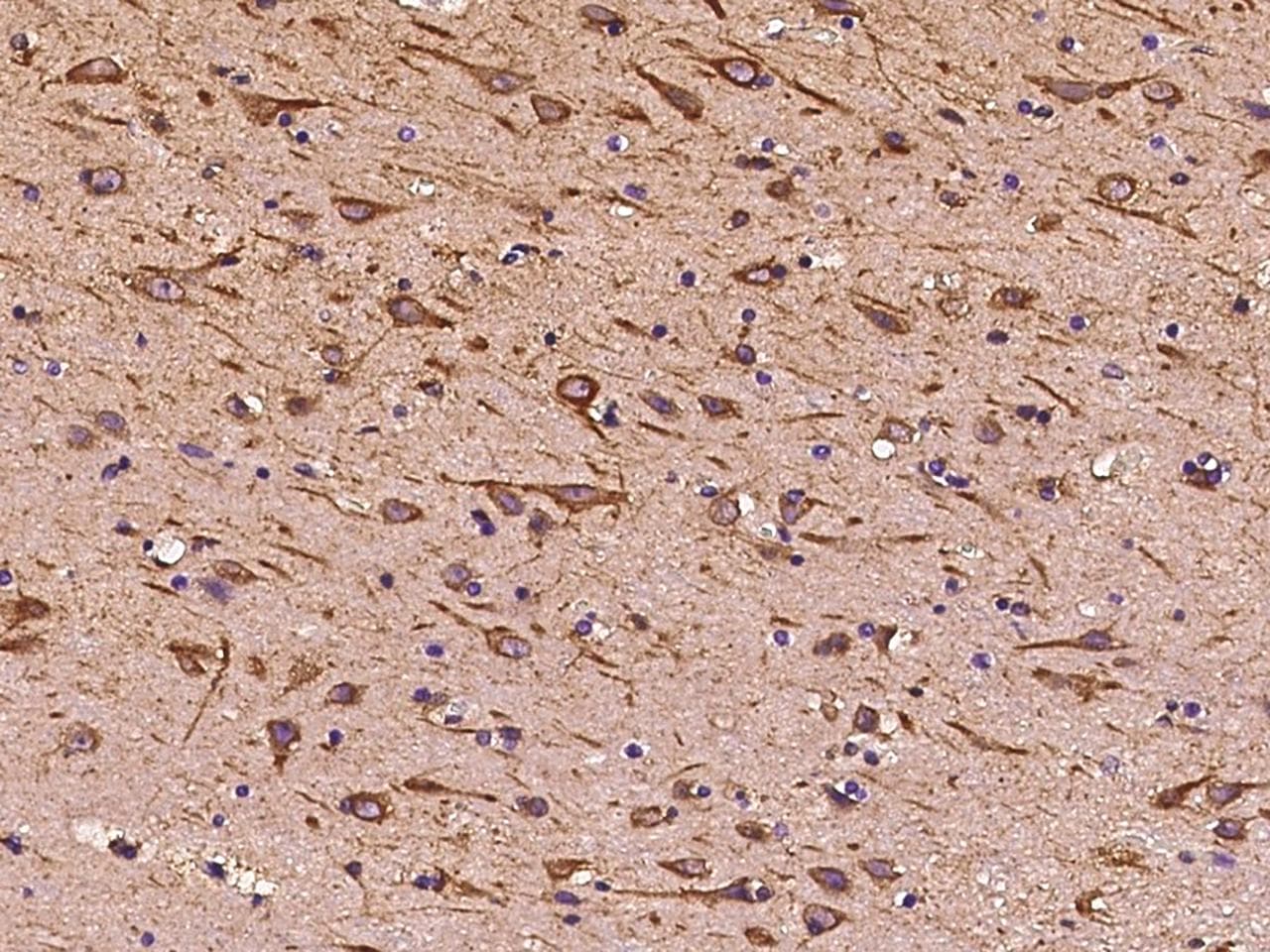ITM2A Antibody