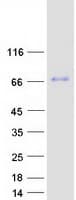 Human MBTD1 Protein (Recombinant Myc-DDK (Flag))
