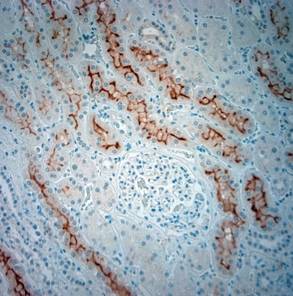 SLC5A8 / AIT Antibody (aa560-610)