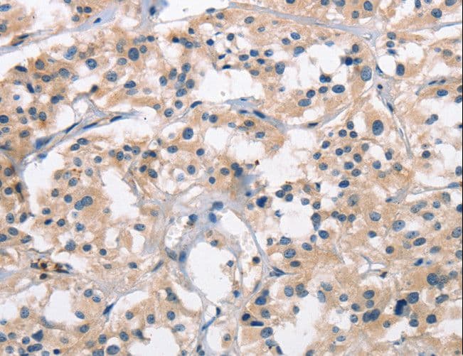 SENP1 Antibody