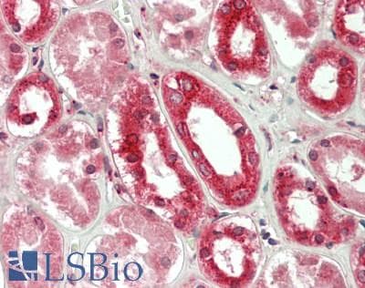IHC-plus™ Polyclonal Rabbit anti-Human PKN1 Antibody (aa246-285, IHC, IF, WB)